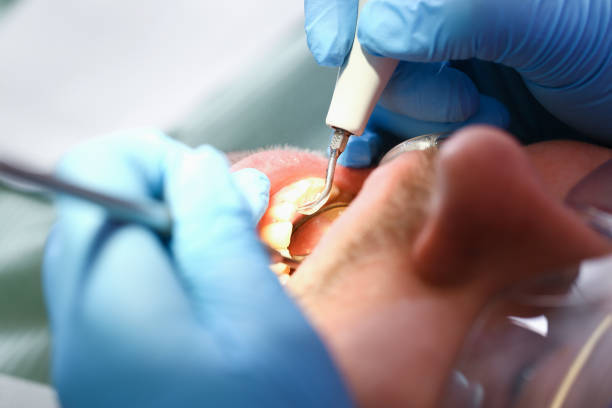 Best Knocked-Out Tooth Emergency  in Falling Water, TN