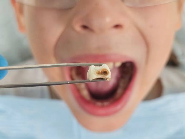 Best Broken Tooth Emergency  in Falling Water, TN